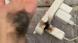 Đeo thứ tưởng chừng vô hại, người phụ nữ suýt mất bàn tay khi cắm điện