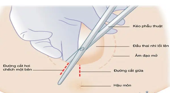 Nỗi sợ kinh hoàng của các mẹ bầu sắp vượt cạn - Ảnh 2.