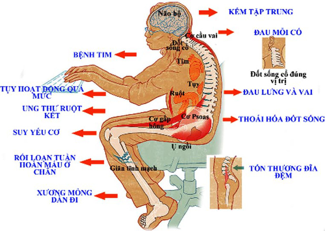 Cảnh báo chứng bệnh ngồi nhiều thời COVID-19 âm thầm hủy hoại sức khỏe của bạn - Ảnh 3.