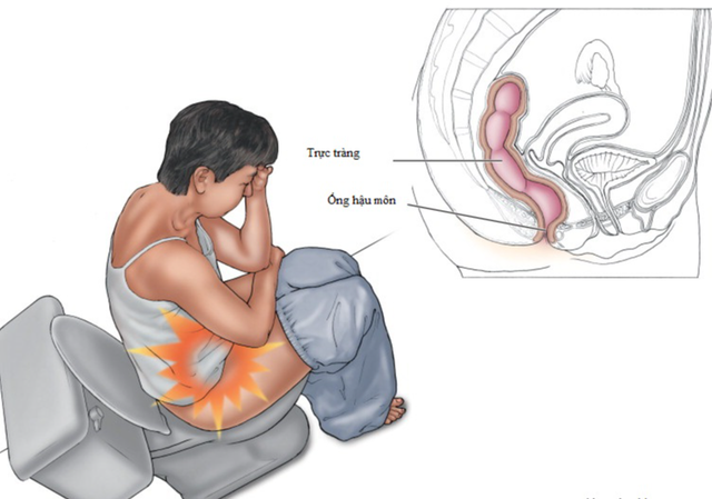 Cảnh báo chứng bệnh ngồi nhiều thời COVID-19 âm thầm hủy hoại sức khỏe của bạn - Ảnh 7.