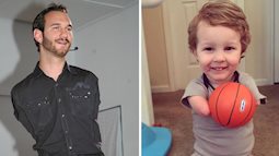 Mắc hội chứng giống Nick Vujicic nhưng cậu bé vẫn lạc quan yêu đời nhờ cách dạy dỗ này của người mẹ