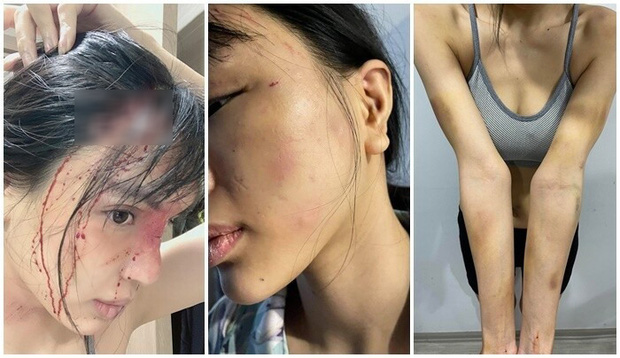 Độc quyền: Phía Khả Trang cung cấp bằng chứng, chia sẻ tường tận chuyện nữ người mẫu nghi bị chồng giam lỏng, bạo hành dã man - Ảnh 7.