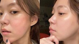 Chăm da buổi sáng mà mắc 4 lỗi này, da mãi không đẹp lên, nếp nhăn xuất hiện sớm