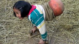 “Cô bé bóng rổ” mất nửa người vẫn lạc quan khiến thế giới cảm phục 15 năm trước: Kinh ngạc với cuộc sống thay đổi hoàn toàn ở hiện tại