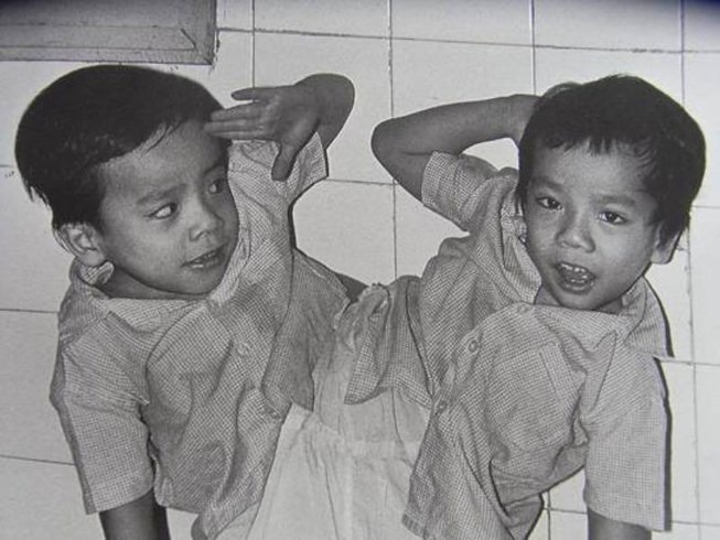 Cuộc sống hiện tại của người em sống sót trong ca tách rời lịch sử cặp sinh đôi Việt - Đức - Ảnh 2.