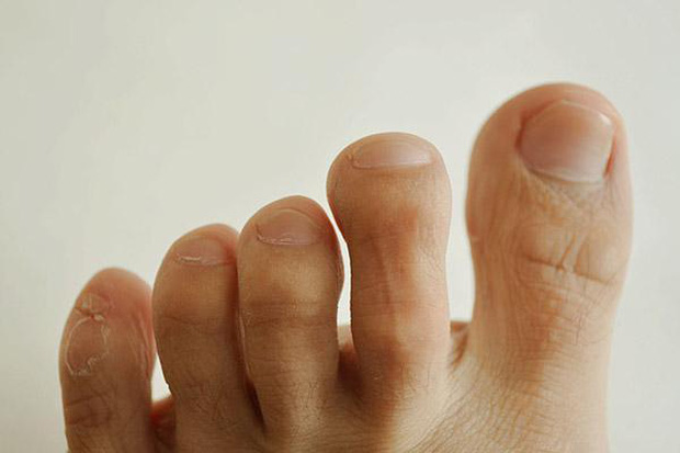 3 đặc điểm bất thường ở bàn chân có thể là dấu hiệu cảnh báo ung thư, xem thử bạn có sở hữu điểm nào không - Ảnh 2.