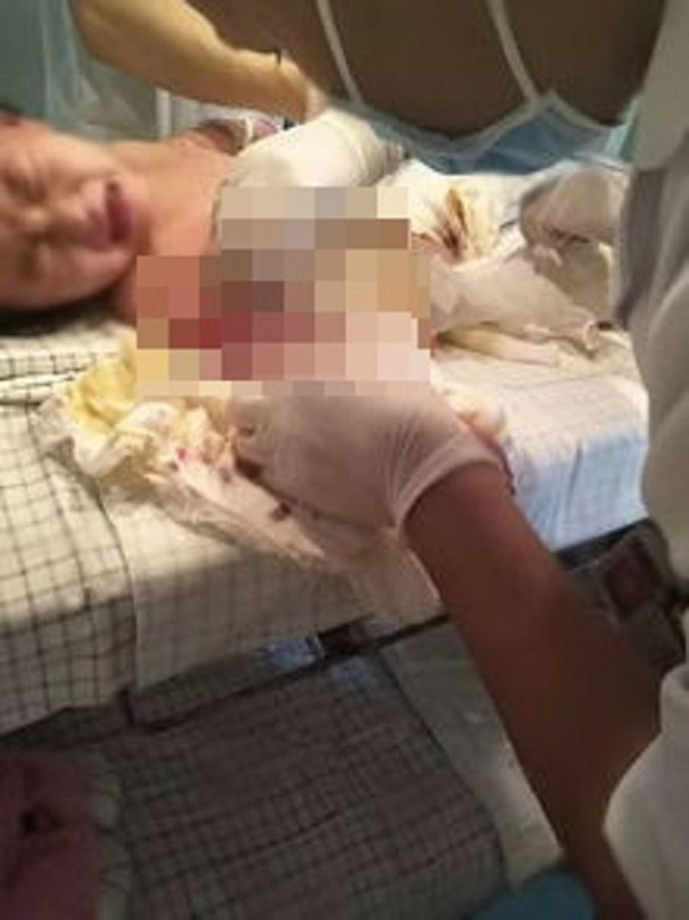 Mẹ tức tốc đưa con bị bỏng đi viện, bác sĩ lập tức báo cảnh sát bắt ả ác nữ vì một dấu hiệu trên cơ thể đứa trẻ - Ảnh 1.