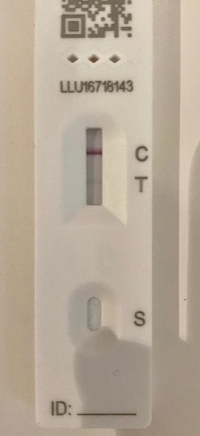 Test nhanh COVID vạch mờ vạch đậm nghĩa là gì? BS giải thích lý do không phải ai cũng biết - Ảnh 1.