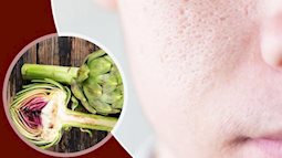 Atiso, 'thần dược' chống lão hóa và ngăn ngừa mụn