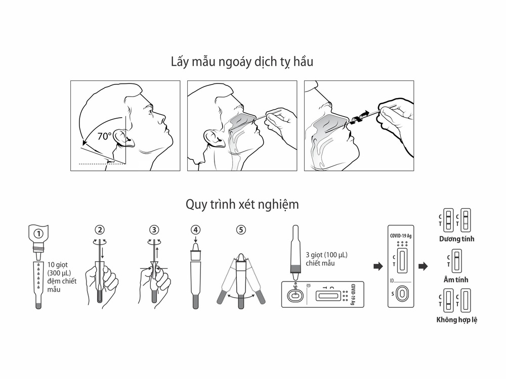 Bản chất của kit test nhanh Covid-19; loại bỏ kit test trôi nổi trong phút mốt - Ảnh 2.