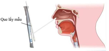 Dương tính giả và cách thực hiện test nhanh tại nhà đúng cách - Ai cũng cần biết! - Ảnh 3.