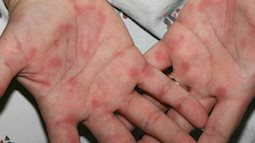 Không yêu đương nhưng vẫn quan hệ tình dục kiểu này, nam  thanh niên chết lặng khi nhận được "tin dữ" không thể ngờ tới từ bạn tình