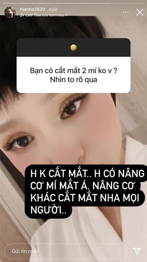 Hiền Hồ: Tiêm má baby, làm răng sứ, nâng cơ mí mắt và tiêm 0,3cc Filler vào mũi để có được nhan sắc... cứng đơ - Ảnh 3.