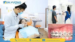 Niềng răng trả góp - Xu hướng kinh doanh mới tốt cho nha khoa, tiện cho khách hàng