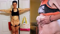 Quyết tâm giảm 152kg để con gái tự hào, người phụ nữ hối hận với cơ thể dị hợm và màn biến hình khó tin sau đó