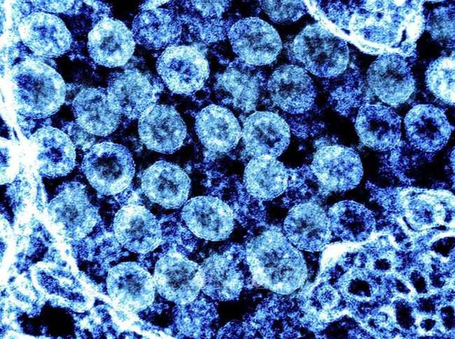 Các biến thể mới của virus SARS-CoV-2 có thực sự đáng quan ngại? - Ảnh 1.