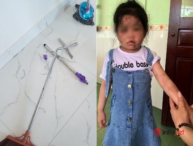 Thông tin mới vụ bé gái 4 tuổi bị dì ruột bạo hành ở Hà Tĩnh - Ảnh 1.