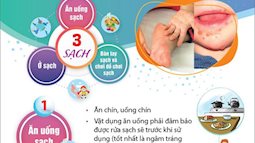 Nguyên tắc "3 sạch" phòng bệnh tay chân miệng