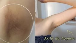 Trị thâm cho vùng nách: Cách nhanh gọn được beauty blogger xứ Hàn duy trì suốt 10 năm không đổi