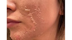 Chuyên gia chỉ ra 3 bước thiết yếu cần làm ngay để da đẹp và ngăn ngừa nám