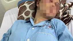 Vụ người phụ nữ bị bạn trai "tra tấn" 4 tiếng: Hội LHPN tỉnh Thanh Hóa lên tiếng