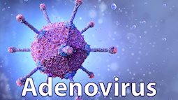 6 trường hợp tử vong vì nhiễm Adenovirus: BS khuyến cáo dấu hiệu nhận biết và việc cần làm để phòng bệnh