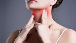 Đau họng, dùng kháng sinh không đỡ: BS chỉ ra nguyên nhân và cảnh báo biến chứng nguy hiểm