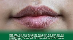 Miệng liên tục gặp phải 4 điều khó chịu này thì có lẽ gan bạn đã bị tổn thương nghiêm trọng
