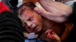 Rất nhiều em bé sơ sinh và trẻ nhỏ sống sót thần kỳ sau nhiều ngày kẹt dưới đống đổ nát, thắp lên hy vọng giữa thảm kịch động đất ở Thổ Nhĩ Kỳ - Syria
