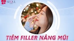  Có nên thực hiện tiêm filler mũi không? Trường hợp nào nên áp dụng?