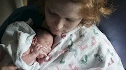 Tiếp xúc da mẹ ngay sau sinh - giải pháp được WHO khuyên dùng cho trẻ sinh non