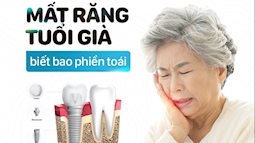  Trồng răng Implant All On 4 tại nha khoa Sài Gòn B.H
