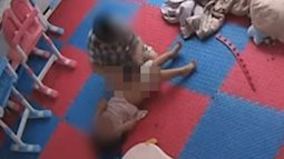 Vụ bé gái 3 tuổi bị bé trai 6 tuổi đánh tím người: Người mẹ tiết lộ tình hình hiện tại