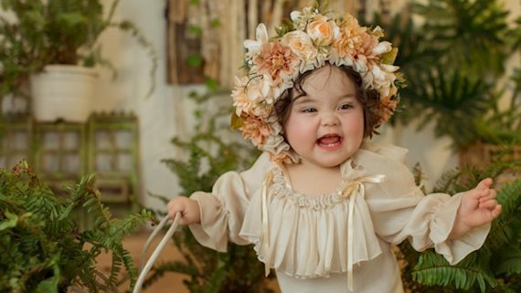 Từng mắc hội chứng lạ khi mới sinh, bé gái 1 tuổi ngày càng nổi tiếng trên MXH nhờ khuôn mặt đáng yêu như thiên thần